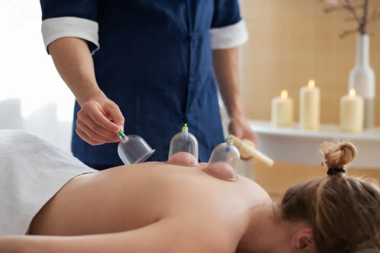 Fisioterapeuta colocando ventosas en la espalda de una paciente
